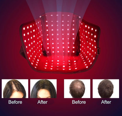 RejuveniCap Pro Red Light Hair Regrowth & Scalp Healing Therapy Device